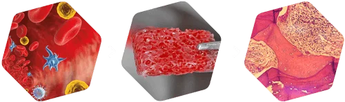 Fisiologia do enxerto com TCO: sangue medular, bloco ósseo enriquecido, histologia da regeneração