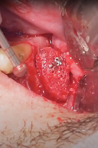 Módulo 6 — Cirurgia filmada e comentada